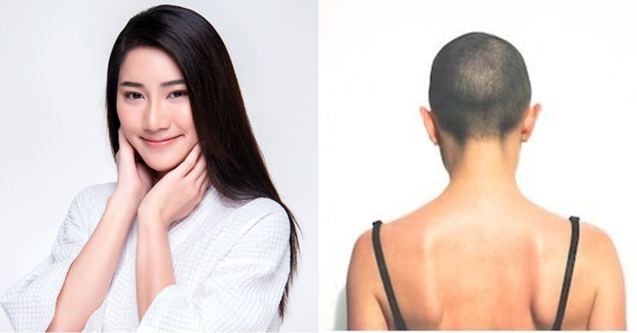 Crush ng Bayan Noon, Kalbo na Ngayon - Inday Trending